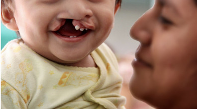 Ni un solo peso costar&aacute;n cirug&iacute;as reconstructivas